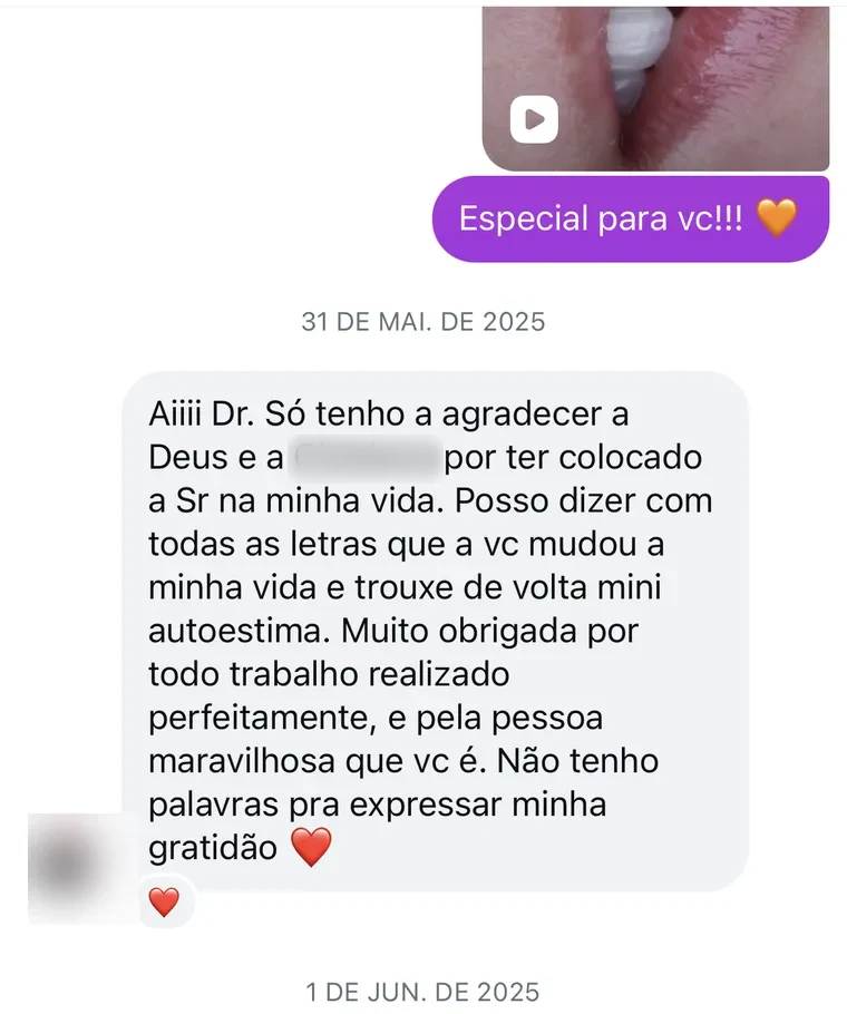 Mensagem no Instagram: a paciente agradece pelo trabalho realizado perfeitamente e diz que a doutora mudou a vida dela e trouxe de volta a autoestima