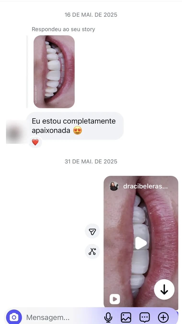 Resposta a um story no Instagram: a paciente escreve “Eu estou completamente apaixonada” ao ver as fotos do sorriso