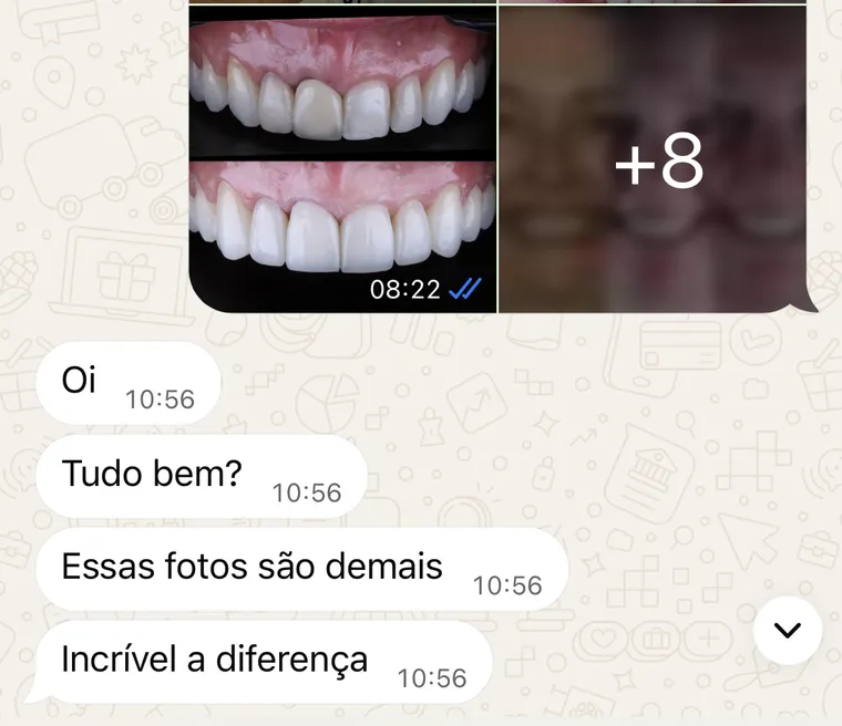 Conversa no WhatsApp: ao receber as fotos de antes e depois, a paciente escreve “Essas fotos são demais. Incrível a diferença”