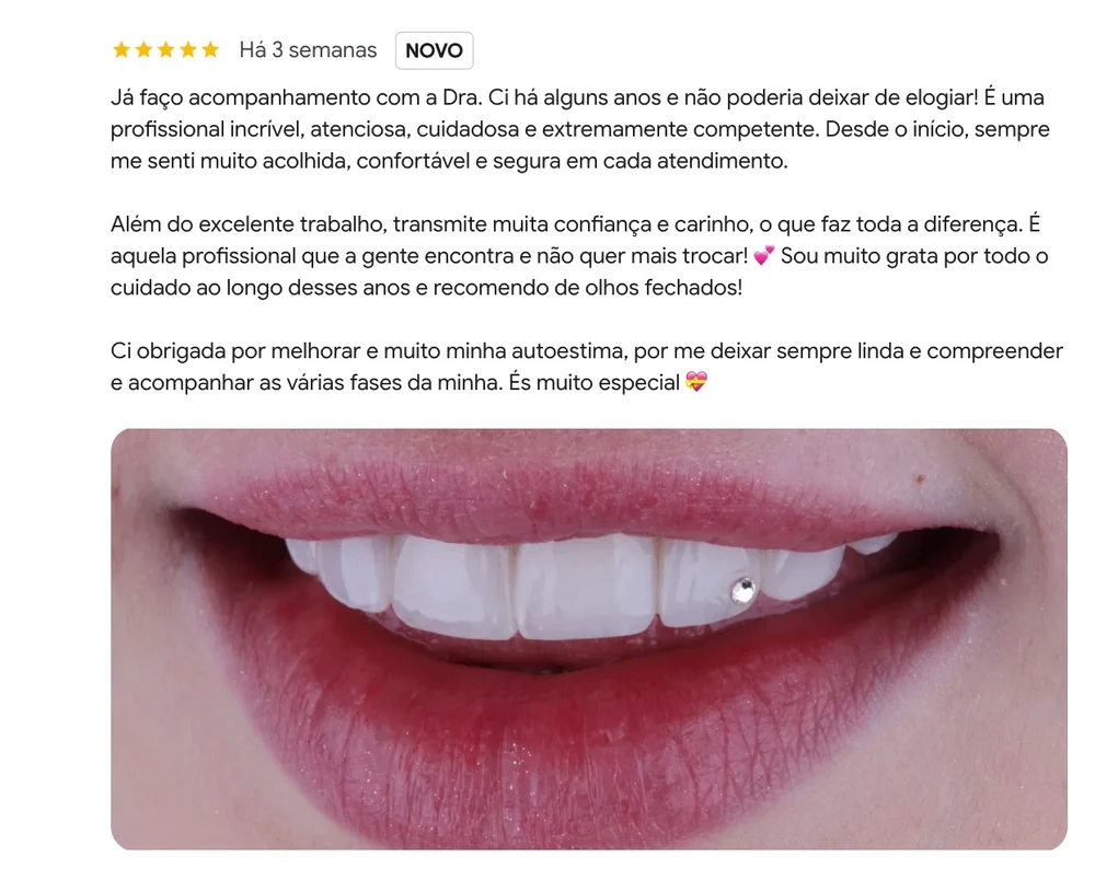 Avaliação de 5 estrelas no Google: paciente acompanhada há anos descreve a Dra. Cibele como atenciosa, cuidadosa e competente, agradece por melhorar a autoestima e recomenda de olhos fechados, com foto do sorriso